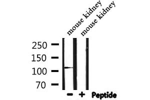 Western blot analysis of extracts from mouse kidney, using IGHMBP2 Antibody. (IGHMBP2 Antikörper  (Internal Region))
