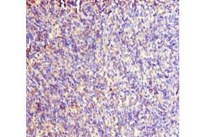 Immunohistochemistry of paraffin-embedded human thymus tissue using ABIN7167019 at dilution of 1:100 (RACGAP1 Antikörper  (AA 353-632))