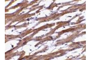 Immunohistochemistry (IHC) image for anti-B-Cell Receptor-Associated Protein 29 (BCAP29) (Middle Region) antibody (ABIN1030880) (BCAP29 Antikörper  (Middle Region))
