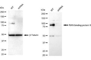 Western blotting analysis using RAN binding protein 9 antibody (ABIN7799025). (Rekombinanter Importin 9 Antikörper)
