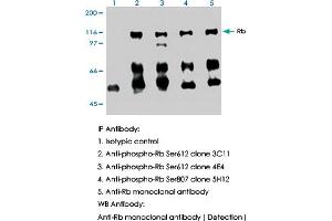 IP-Western blotting in HL-60 cell lysate using RB1 (phospho S612) monoclonal antibody, clone 3C11 (Cat # MAB0003 ; Lane 2). (Retinoblastoma 1 Antikörper  (pSer612))