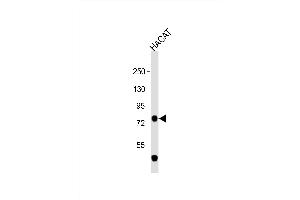 Anti-TP63 Antibody (C-term) at 1:1000 dilution + HACAT whole cell lysate Lysates/proteins at 20 μg per lane.
