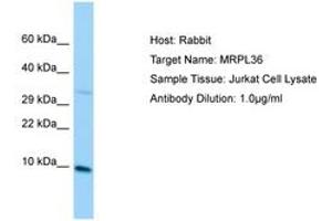 Image no. 1 for anti-BRCA1 Interacting Protein C-terminal Helicase 1 (BRIP1) (C-Term) antibody (ABIN6750116) (BRIP1 Antikörper  (C-Term))