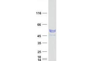 Western Blotting (WB) image for Katanin P60 Subunit A-Like 2 (KATNAL2) protein (Myc-DYKDDDDK Tag) (ABIN2723984)