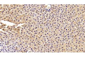 Detection of FASN in Rat Liver Tissue using Polyclonal Antibody to Fatty Acid Synthase (FASN) (Fatty Acid Synthase Antikörper  (AA 2263-2512))