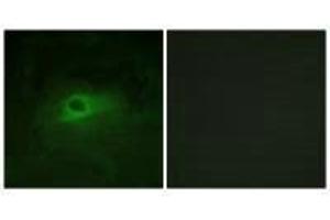Immunofluorescence analysis of HeLa cells, using CSFR (Ab-809) antibody. (CSF1R Antikörper  (Tyr809))