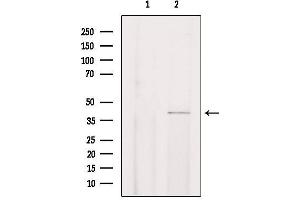 CHST13 Antikörper  (Internal Region)