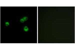 Immunofluorescence analysis of MCF-7 cells, using OR7E5P Antibody. (OR7E5P Antikörper  (AA 35-84))