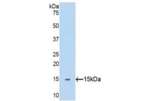 Detection of Recombinant SEMA5B, Human using Polyclonal Antibody to Semaphorin 5B (SEMA5B) (SEMA5B Antikörper  (AA 36-161))