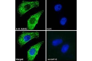 (ABIN184952) Immunofluorescence analysis of paraformaldehyde fixed HeLa cells, permeabilized with 0.