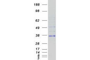 Chromosome 1 Open Reading Frame 186 (C1orf186) protein (Myc-DYKDDDDK Tag)