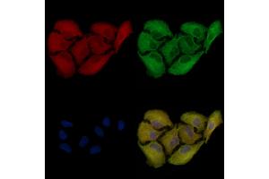 ABIN6256898 and ABIN6274828 staining  cells by IF/ICC.