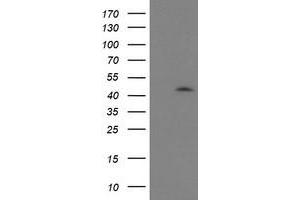 HEK293T cells were transfected with the pCMV6-ENTRY control (Left lane) or pCMV6-ENTRY GDAP1L1 (Right lane) cDNA for 48 hrs and lysed. (GDAP1L1 Antikörper)