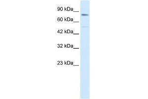 Human HepG2; WB Suggested Anti-ZNF341 Antibody Titration: 0. (ZNF341 Antikörper  (Middle Region))