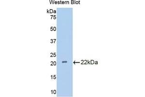 Detection of Recombinant IL18BP, Rat using Polyclonal Antibody to Interleukin 18 Binding Protein (IL18BP) (IL18BP Antikörper  (AA 29-193))