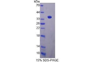 SDS-PAGE analysis of Mouse CABIN1 Protein. (CABIN1 Protein)