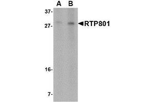 Image no. 1 for anti-DNA-Damage-Inducible Transcript 4 (DDIT4) (N-Term) antibody (ABIN1494371) (DDIT4 Antikörper  (N-Term))