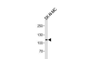Western blot analysis of lysate from SK-N-MC cell line, using NOC3L Antibody (N-term) (ABIN657897 and ABIN2846849). (NOC3L Antikörper  (N-Term))