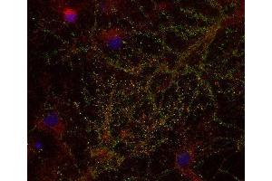 Indirect immunostaining of PFA fixed rat hippocampus neurons with anti-DAP 4 (dilution 1 : 500; green) and mouse anti-synapsin 1 (, dilution 1 : 500; green).
