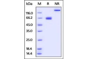 Human PD-L1, mouse IgG1 Fc Tag on SDS-PAGE under reducing (R) and no-reducing (NR) conditions. (PD-L1 Protein (AA 19-238) (Fc Tag))