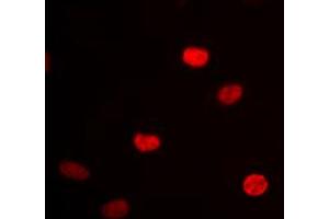 Immunofluorescence (IF) image for anti-Heterogeneous Nuclear Ribonucleoprotein D (HNRNPD) (Center) antibody (ABIN7300834)