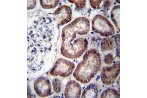 Immunohistochemistry analysis in formalin fixed and paraffin embedded human kidney tissue reacted with IREB2 Antibody (Center) followed by peroxidase conjugation of the secondary antibody and DAB staining. (IREB2 Antikörper  (Middle Region))
