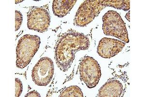 IHC analysis of PEF1 using anti-PEF1 antibody (ABIN6719632).