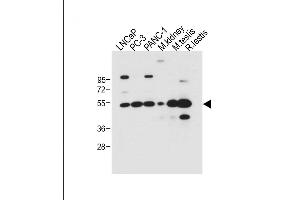 All lanes : Anti-DMRT3 Antibody (C-term) at 1:500 dilution Lane 1: LNCaP whole cell lysate Lane 2: PC-3 whole cell lysate Lane 3: NC-1 whole cell lysate Lane 4: Mouse kidney tissue lysate Lane 5: Mouse testis tissue lysate Lane 6: Rat testis tissue lysate Lysates/proteins at 20 μg per lane. (DMRT3 Antikörper  (C-Term))