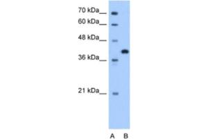 Western Blotting (WB) image for anti-Torsin Family 2, Member A (TOR2A) antibody (ABIN2463328)