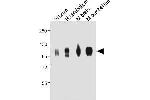 All lanes : Anti-G Antibody (Center) at 1:2000 dilution Lane 1: Hun brain whole tissue lysate Lane 2: Hun cerebellum whole tissue lysate Lane 3: Mouse brain whole tissue lysate Lane 4: Mouse cerebellum whole tissue lysate Lysates/proteins at 20 μg per lane. (MAG Antikörper  (AA 439-466))