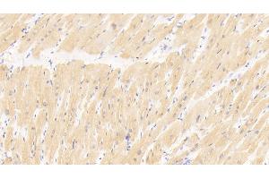 Detection of MYL3 in Human Cardiac Muscle Tissue using Polyclonal Antibody to Myosin Light Chain 3, Alkali, Ventricular, Slow Skeletal (MYL3) (MYL3/CMLC1 Antikörper  (AA 5-181))