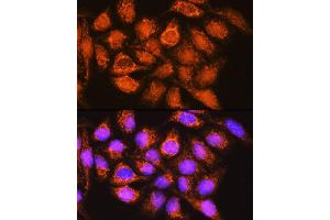 Immunofluorescence analysis of HeLa cells using B1 Rabbit pAb (ABIN1678629, ABIN3018003, ABIN3018005 and ABIN6220332) at dilution of 1:100. (ALDH1B1 Antikörper  (AA 278-517))