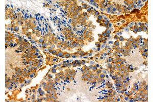 ABIN6261582 and ABIN6276939 at 1/100 staining Mouse testis tissue by IHC-P. (EPXH2 (C-Term) Antikörper)