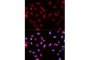 Immunofluorescence analysis of U2OS cells using BIRC5 antibody (ABIN5970737). (Survivin Antikörper)