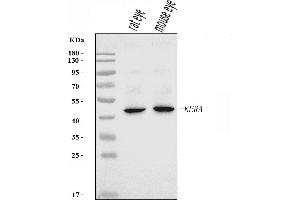 Western blot analysis of Keratocan/KTN/Kera using anti-Keratocan/KTN/Kera antibody (ABIN7602381).