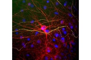 View of mixed neuron/glial cultures stained with ABIN1842224 (red) and rabbit antibody to phosphorylated NF-H (RPCA- NF-H, green).