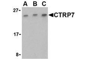 Western blot analysis of CTRP7 in 293 cell lysate with AP30258PU-N CTRP7 antibody at (A) 0. (CTRP7 Antikörper  (C-Term))