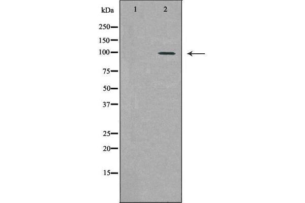 PML Antikörper  (N-Term)