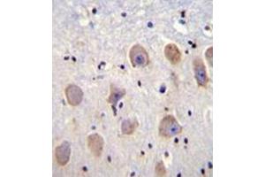 Immunohistochemistry analysis in formalin fixed and paraffin embedded human brain tissue reacted with KCNK1 Antibody (C-term) followed which was peroxidase conjugated to the secondary antibody and followed by DAB staining.