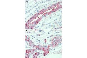 Immunohistochemical staining of human kidney (A) and human breast (B) with SLC4A2 polyclonal antibody . (SLC4A2 Antikörper  (N-Term))
