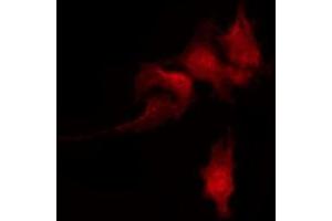 Immunofluorescence (fixed cells) (IF/ICC) image for anti-Adducin 1 (Alpha) (ADD1) (pSer726) antibody (ABIN6255485)