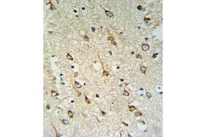 DNAJC6 Antibody (Center) (ABIN653940 and ABIN2843170) IHC analysis in formalin fixed and paraffin embedded human brain tissue followed by peroxidase conjugation of the secondary antibody and DAB staining.