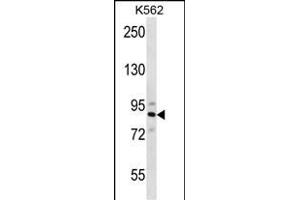 STRN4 Antikörper  (N-Term)