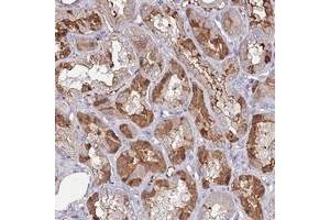 Immunohistochemical staining of human kidney with C10orf129 polyclonal antibody  shows moderate cytoplasmic positivity in renal tubules. (C10ORF129 Antikörper)