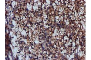 Image no. 9 for anti-Complement Component 1, S Subcomponent (C1S) antibody (ABIN1497565) (C1S Antikörper)