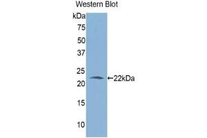 Detection of Recombinant ALDH1A3, Human using Polyclonal Antibody to Aldehyde Dehydrogenase 1 Family, Member A3 (ALDH1A3) (ALDH1A3 Antikörper  (AA 332-509))