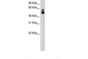 Image no. 2 for anti-Histone Deacetylase 9 (HDAC9) (C-Term) antibody (ABIN205000) (HDAC9 Antikörper  (C-Term))