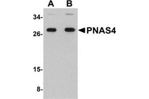 Western Blotting (WB) image for anti-PPPDE Peptidase Domain Containing 1 (PPPDE1) (C-Term) antibody (ABIN1030594)