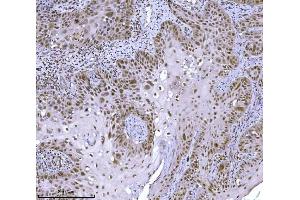 IHC analysis of JHDM3A/JMJD2A/KDM4A using anti-JHDM3A/JMJD2A/KDM4A antibody (ABIN7601534).