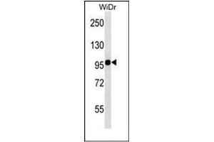 Western blot analysis of ITGB7 Antibody (C-term) in WiDr cell line lysates (35ug/lane).